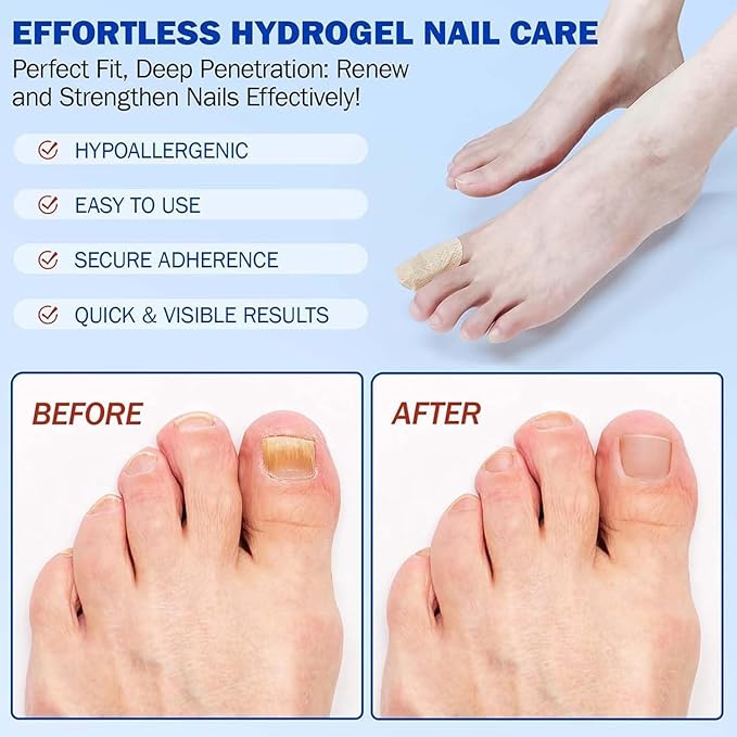 Nail Repair Patches,21 Pieces Extra Strong 8-Hour Repair Pads for Toenail Fungus, Ingrown Nail Relief Damaged Nail Recovery