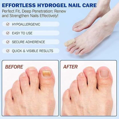 Nail Repair Patches,21 Pieces Extra Strong 8-Hour Repair Pads for Toenail Fungus, Ingrown Nail Relief Damaged Nail Recovery